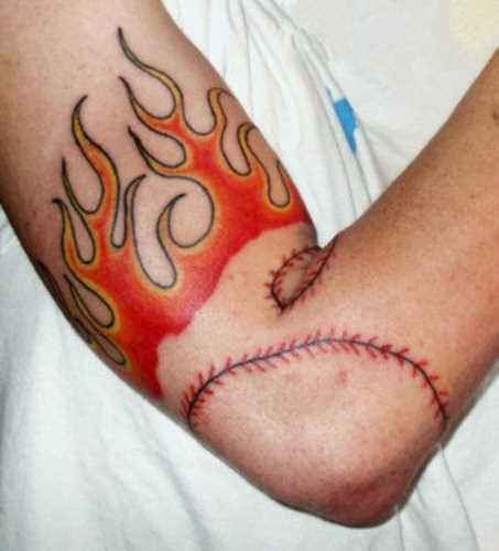 Tatuagem no braço de um cara - chama
